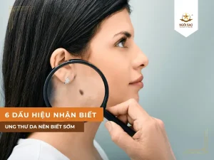 Dấu hiệu nhận biết căn bệnh ung thư da