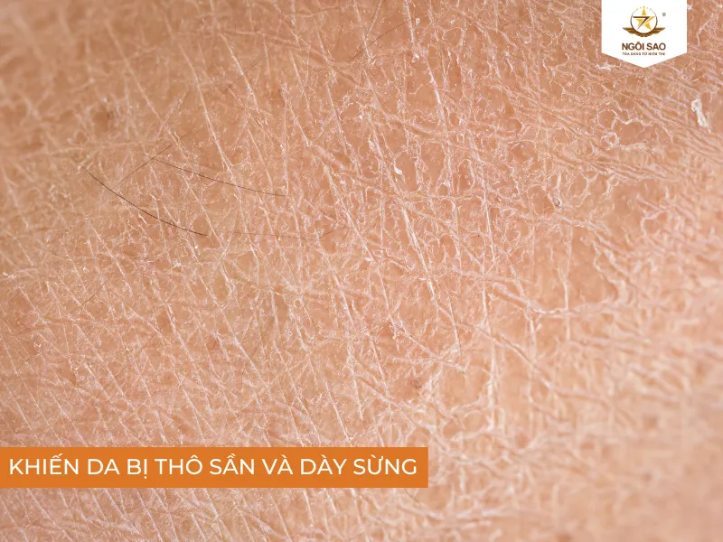 Tiếp xúc với ánh nắng mặt trời trong thời gian dài khiến làn da thô sần và dày sừng